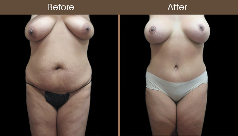 20202705155545_B27-Front